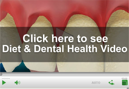 Diet Dental Health Video