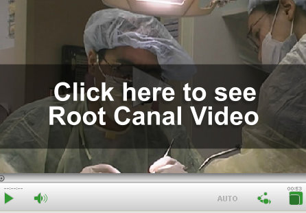 Root Canal Video