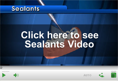 Dental Sealant Video Link