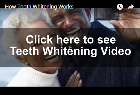 Teeth Whitening Video