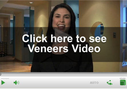 Veneer Video