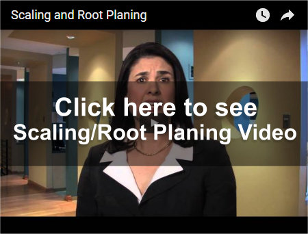 Scaling and Root Planing Video