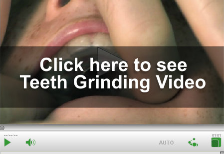 Teeth Grinding Video