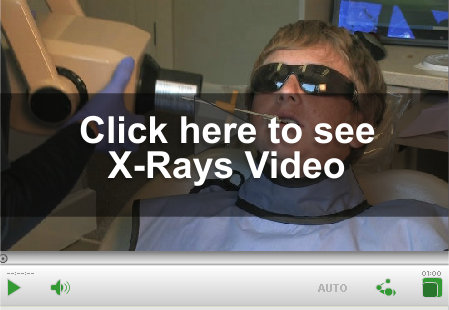 XRay Video Link